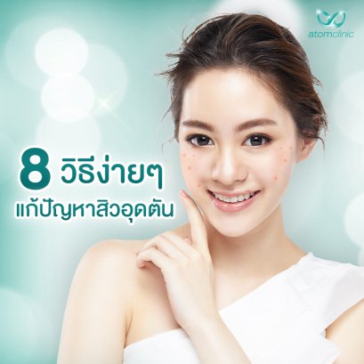 วิธีแก้ปัญหาสิว