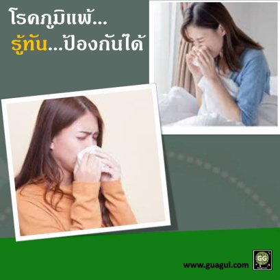 ภูมิแพ้/ SLE