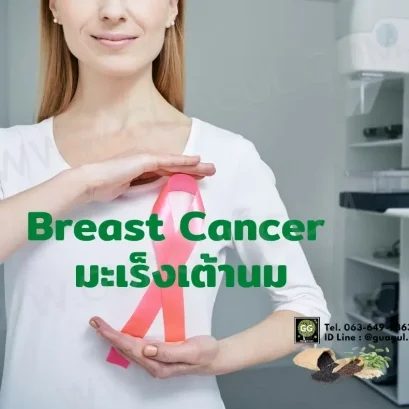 ฺBreast Cancer
