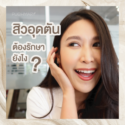 สิวอุดตัน ต้องรักษายังไง คลิปนี้มีคำตอบ