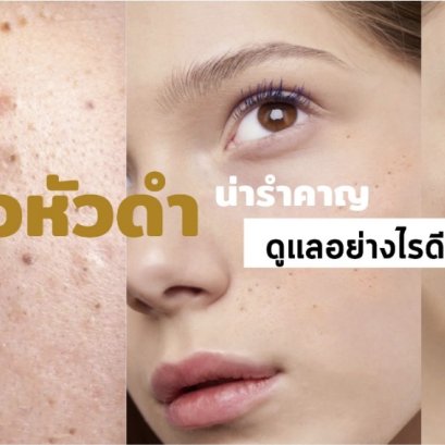  จุดดำเล็กบนใบหน้าแก้ปัญหาอย่างไรดี?