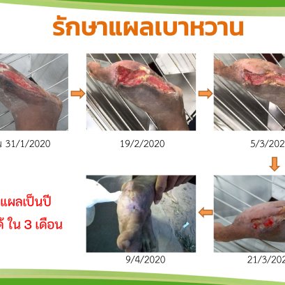 แผลเบาหวาน ที่เป็นนานกว่า 4 ปี หายได้ ในสามเดือน