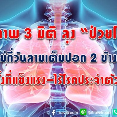 ตะลึงภาพ 3 มิติ ลุง “ป่วยโควิด” ไม่กี่วันลามเต็มปอด 2 ข้าง ทั้งที่แข็งแรง-ไร้โรคประจำตัว 
