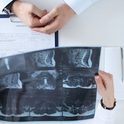 腰椎间盘突出，上班族的痛，华侨中医院名医教你解决痛处