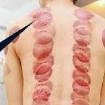 你拔的是正经罐吗？