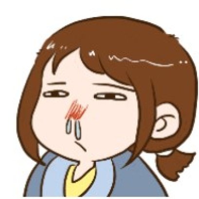 鼻炎久了 谨防“臭鼻病”