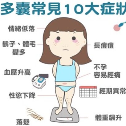 多囊卵巢综合症能生宝宝吗？