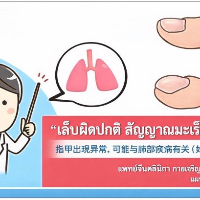 冯解语中医师讲解指甲异常，可能是肺癌信号!