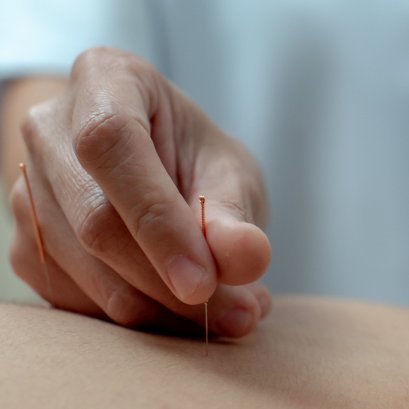 温珍慧资深中医师讲解针灸治疗偏头痛的优势