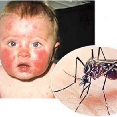 APCO - ไขความลับปราบไวรัส 