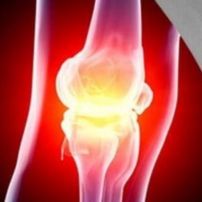 APCO - รักษาเข่าเสื่อมด้วยธรรมชาติ