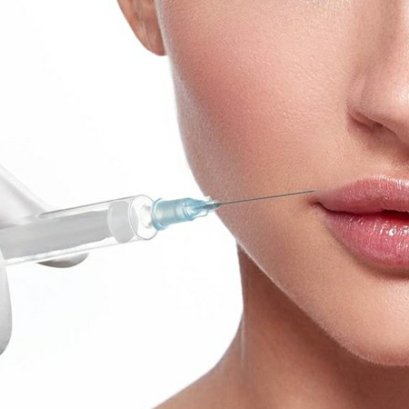 4 ข้อต้องรู้ก่อนฉีดฟิลเลอร์ที่ปาก