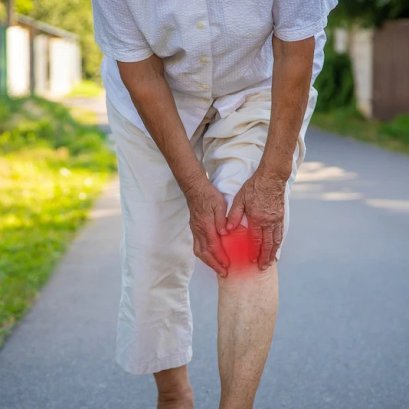 สัญญาณเตือน ข้อเข่าเสื่อมอาการเป็นอย่างไร