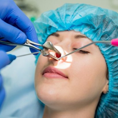 การเลือกคลินิกทำจมูก เชียงใหม่ อยากสวยอยากปัง ต้องเข้ามาดู