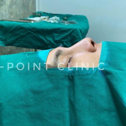 ความแตกต่างระหว่าง การศัลยกรรมจมูกในผู้ชาย และผู้หญิง