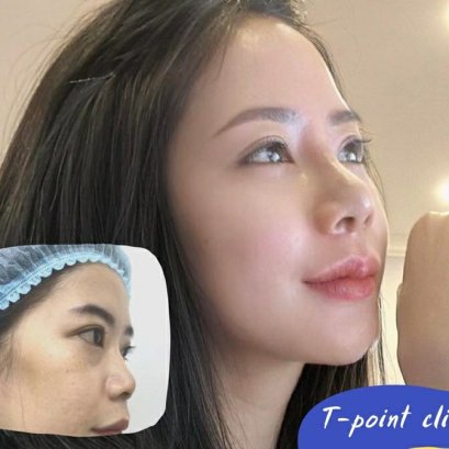 เคล็ดลับเลือกคลินิกเสริมจมูกเชียงใหม่ ที่เชื่อถือได้