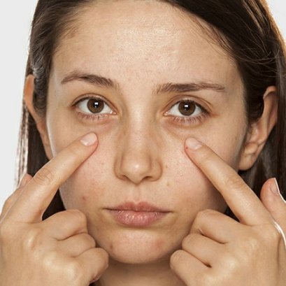 ตาดำเป็นแพนด้า แก้ปัญหาอย่างไรดี ฉีดใต้ตาคล้ำดีไหม