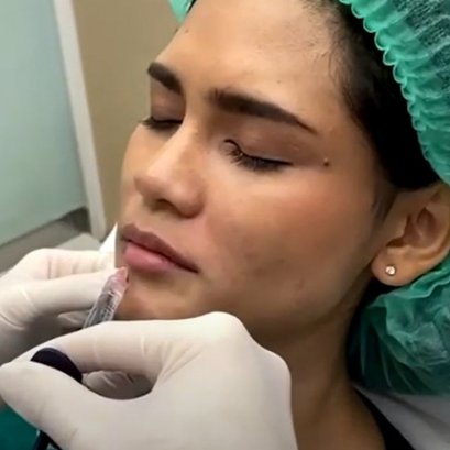 การดูแลตัวเองหลังจาก ฉีดปากอวบอิ่ม