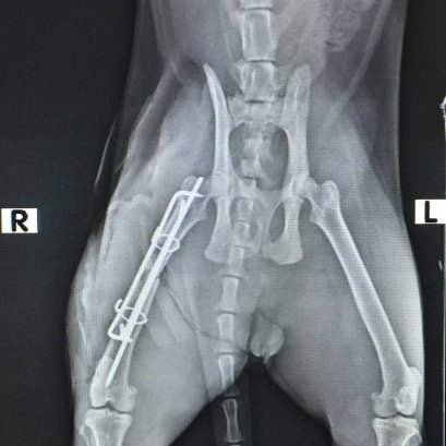 เมื่อเจ้าตัวน้อย กระดูกขาหัก จะทำอย่างไร???