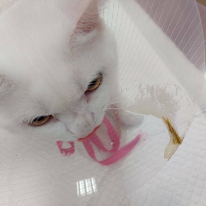 งดน้ำงดอาหารก่อนผ่าตัด สำคัญแค่ไหน ???