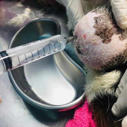 Sialocele หรือ ซีสต์ต่อมน้ำลาย 