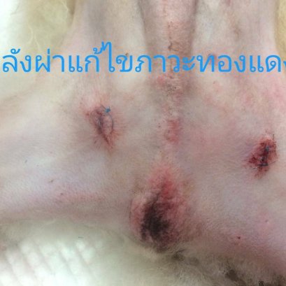 ภาวะทองแดง ไม่ทำหมันก็ได้หรอ ???