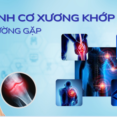 Các Dấu Hiệu Nhận Biết Sớm Bệnh Xương Khớp  