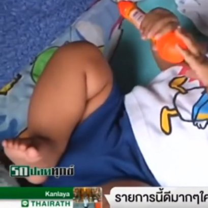 ทายาทหมอรักษามะเร็งชื่อดัง รับเคส น้องฟ้าใส ป่วยเป็นมะเร็งที่ตา รักษาฟรีตลอดไป