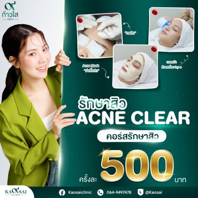 Acne clear