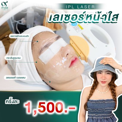 IPL LASER