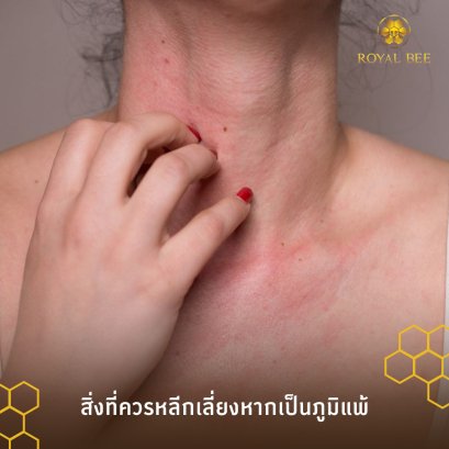 เลี่ยงสิ่งเหล่านี้ซะ! ถ้าไม่อยากเป็น “ภูมิแพ้”