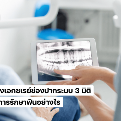 เครื่องเอกซเรย์ช่องปากระบบ 3 มิติ