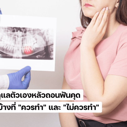 การดูแลตัวเองหลังผ่าฟันคุด