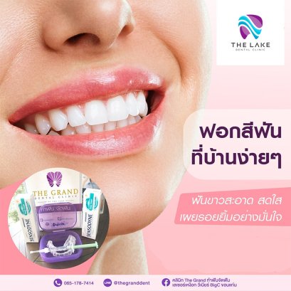 ฟอกสีฟัน ขอนแก่น