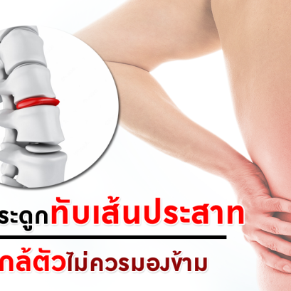 หมอนรองกระดูกทับเส้นประสาท : ภัยร้ายใกล้ตัวไม่ควรมองข้าม