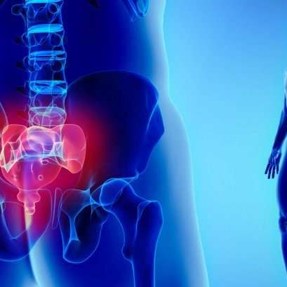 อาการปวดก้นกบเกิดจากอะไร?