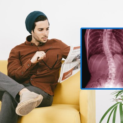 นั่งไขว่ห้างนานๆระวังกระดูกหลังคด!!!