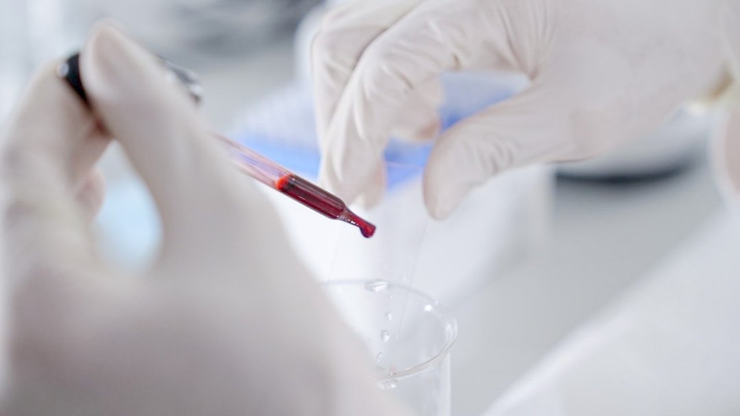 Sip Lab บริการวิเคราะห์และทดสอบด้วยเซลล์ - SIP Lab | Science Innovative ...