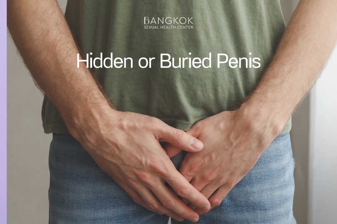 Hidden or Buried Penis | BSHC