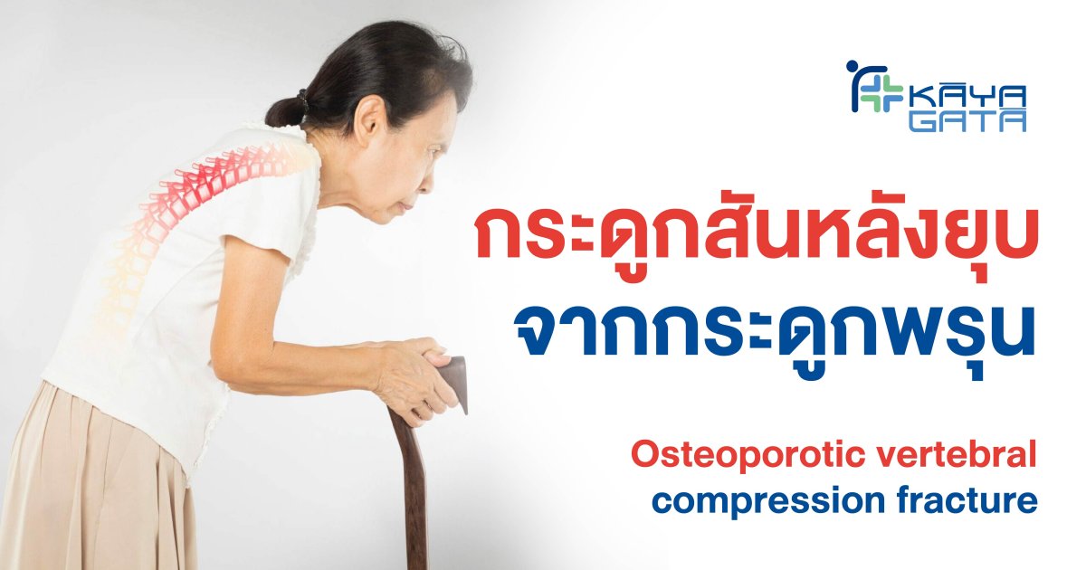 Osteoporotic Vertebral Compression Fracture