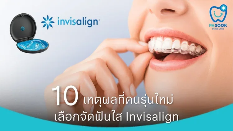 10 Reasons Why the New Generation Prefers Invisalign Clear Aligners