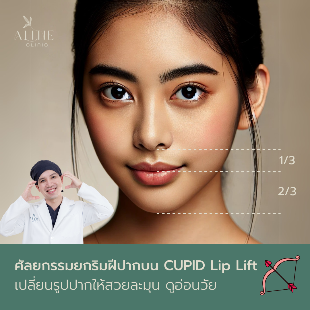 ศัลยกรรมยกริมฝีปากบน CUPID Lip Lift เปลี่ยนรูปปากให้สวยละมุน ดูอ่อนวัย