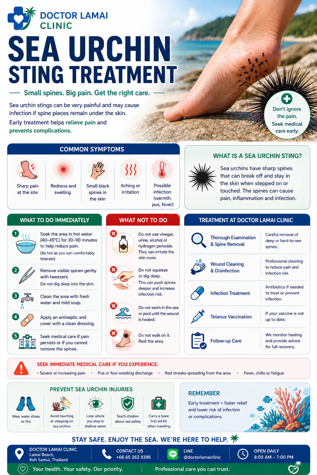 Sea Urchin Sting Treatment Koh Samui. The 2026 Guide to Marine First Aid