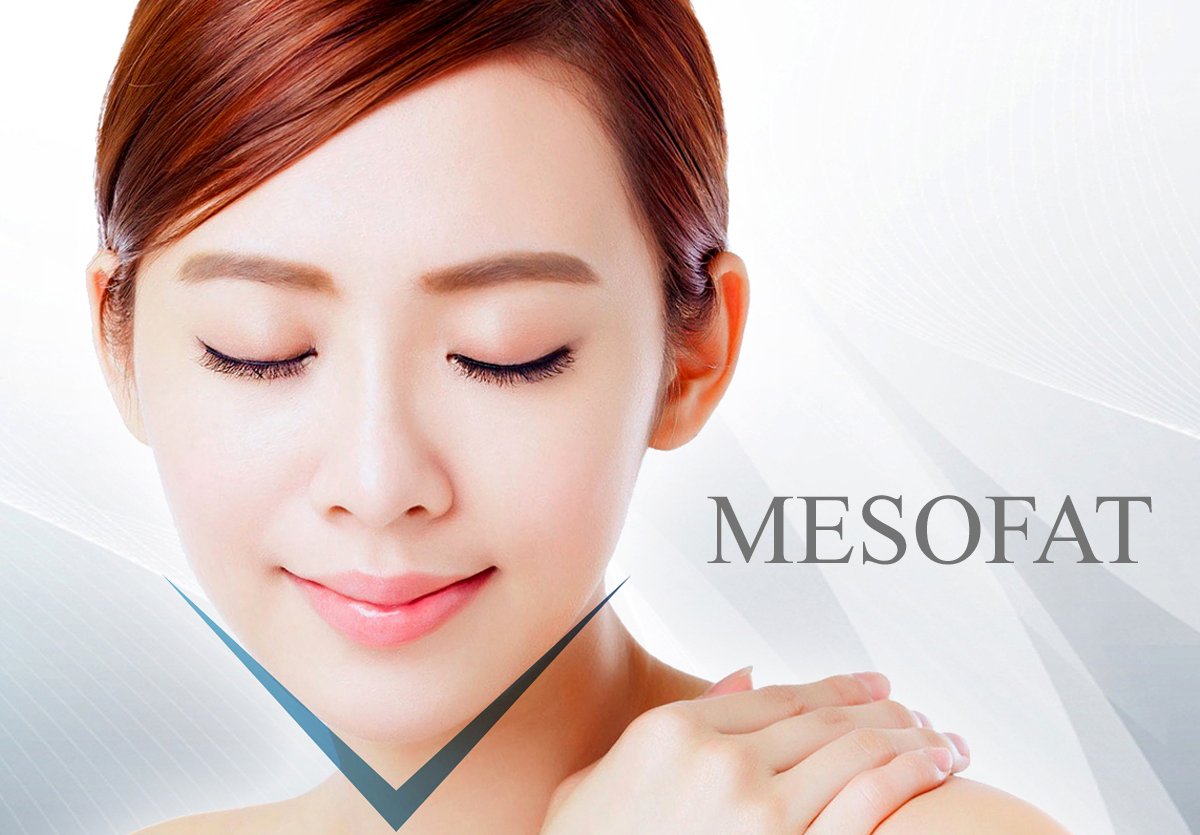 เมโสแฟต ลดปัญหาเหนียง ปรับรูปหน้าให้คม (Meso fat)