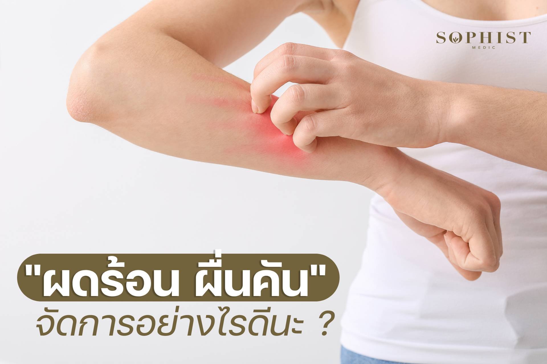 ผดร้อน ผื่นคัน ผดเหงื่อ เกิดจากอะไร วิธีแก้ วิธีรักษา