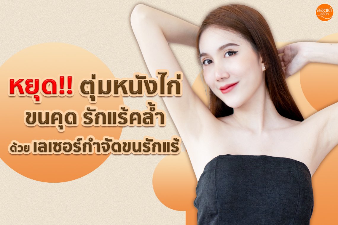 หยุดหนังไก่ รักแร้ดำเป็นขนคุด ด้วยเลเซอร์กำจัดขนรักแร้ ที่ ลอตเต้คลินิก