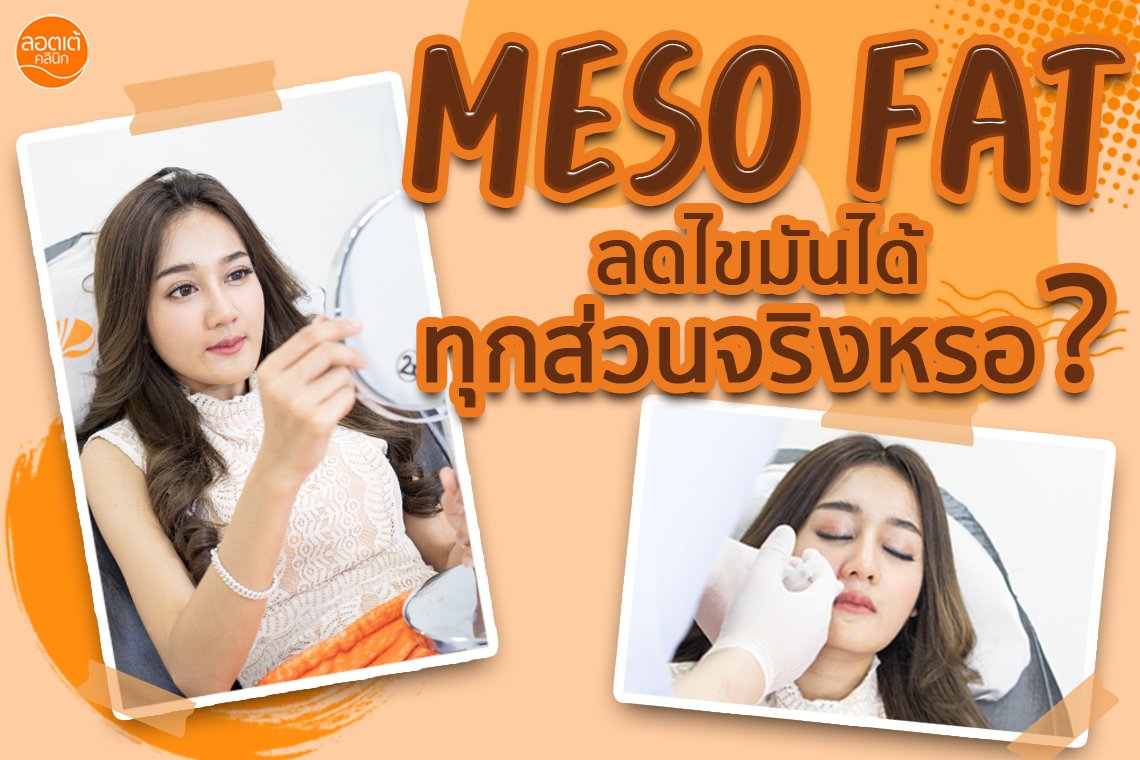 Meso Fat คือ ลดไขมันได้ทุกส่วนจริงมั้ย?