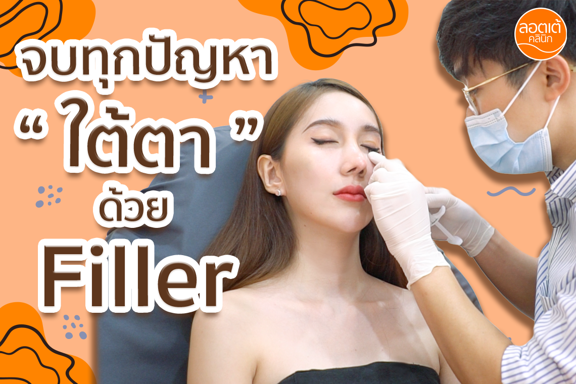 จบทุกปัญหาใต้ตาด้วย Filler