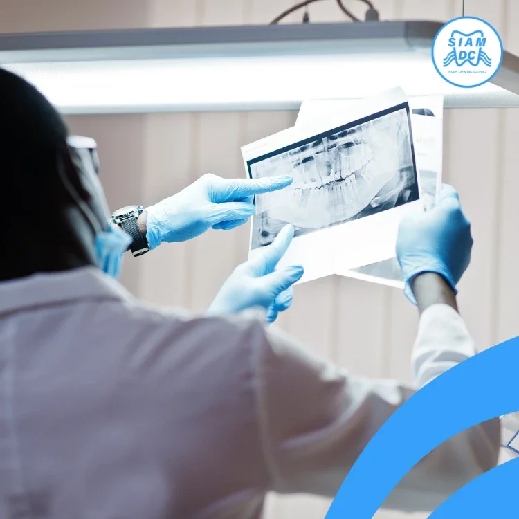 X-Ray ดูขากรรไกร