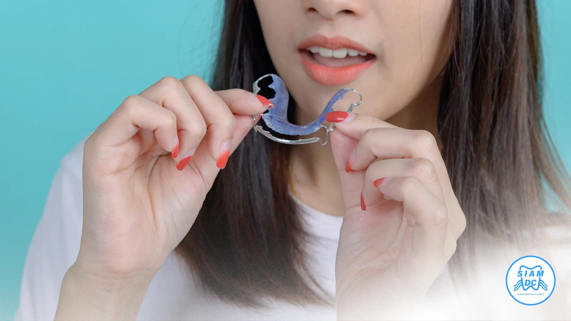 เฝือกสบฟัน Occlusal Splint